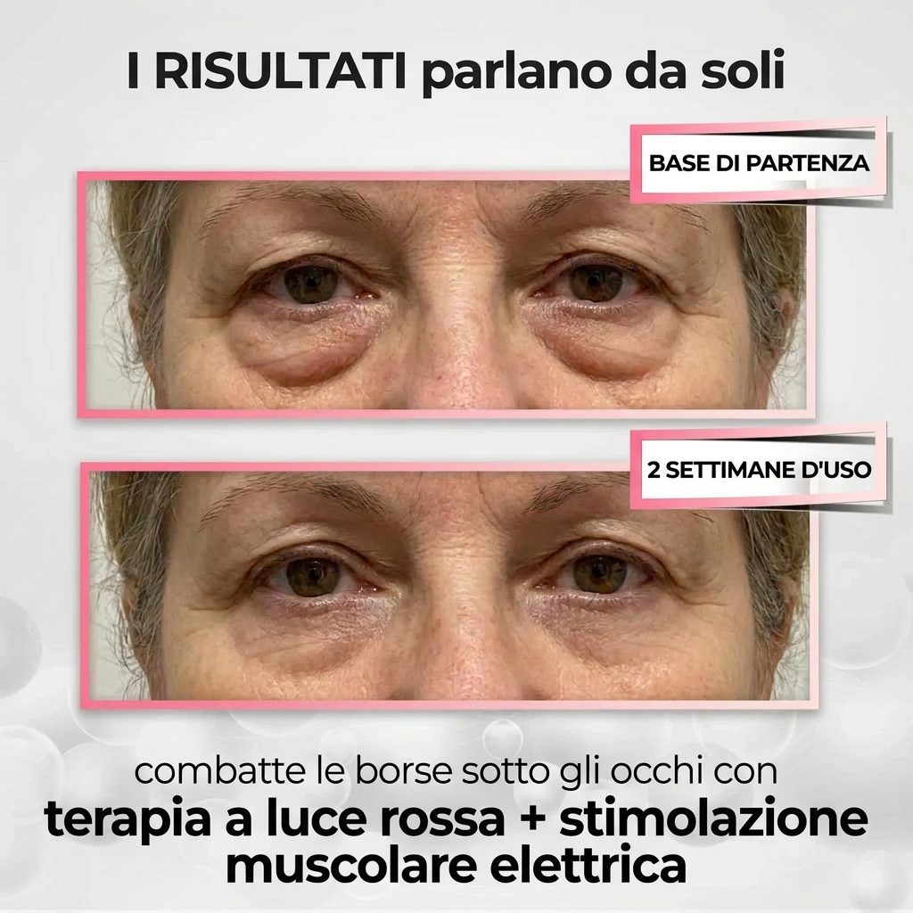 Skaira EyeLift© | 2-in-1 Luce Rossa + EMS — Contrasta Borse e Occhiaie