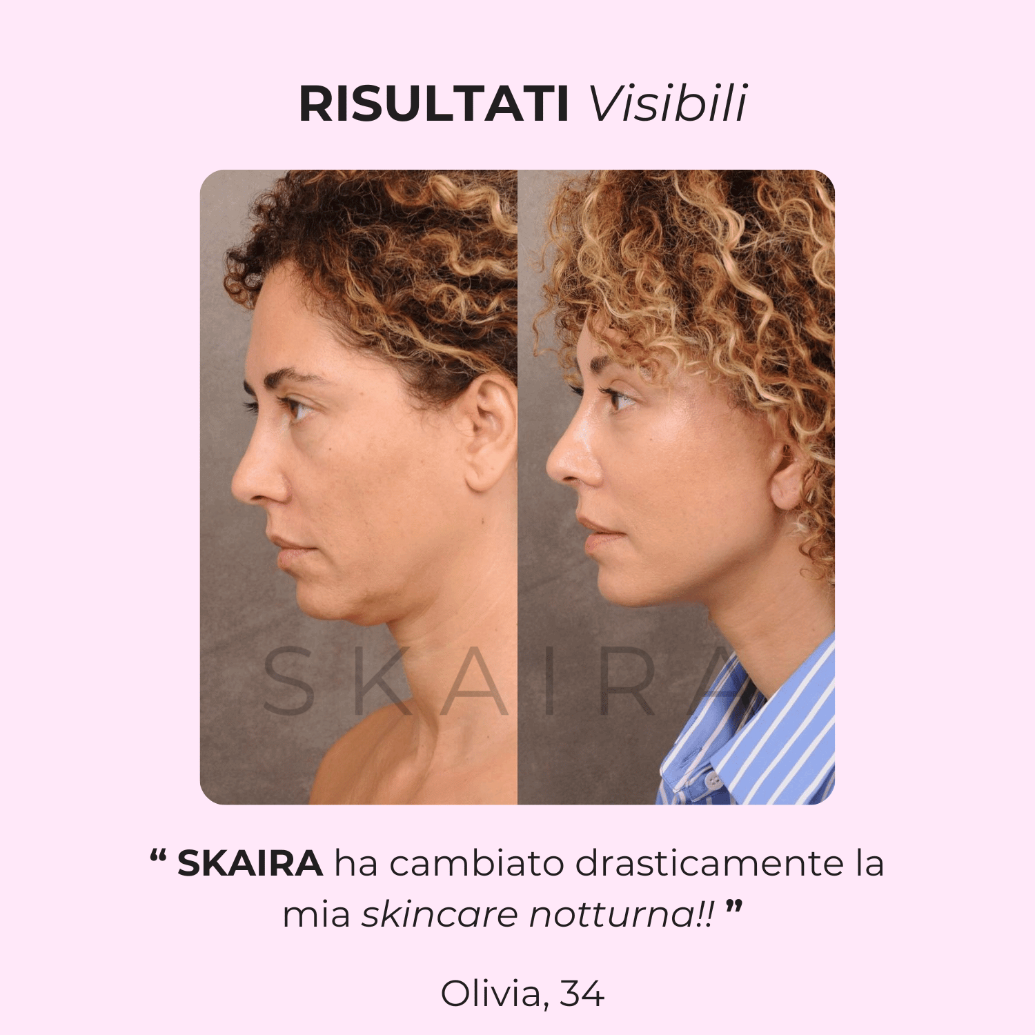 Skaira© | Massaggiatore viso con RED THERAPY